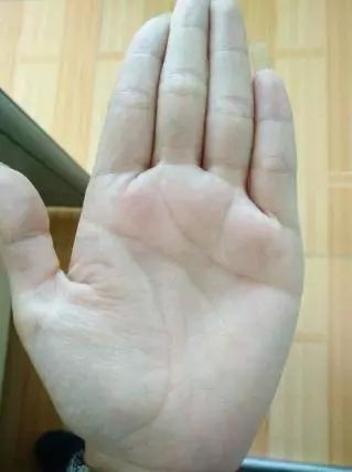 断掌真假辨别_断掌手相解读_断掌三线合一